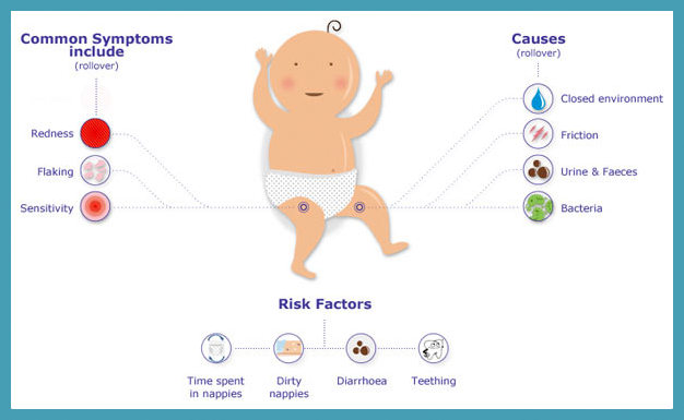 Diaper Rash How to Heal & Deal with It all things GUD!