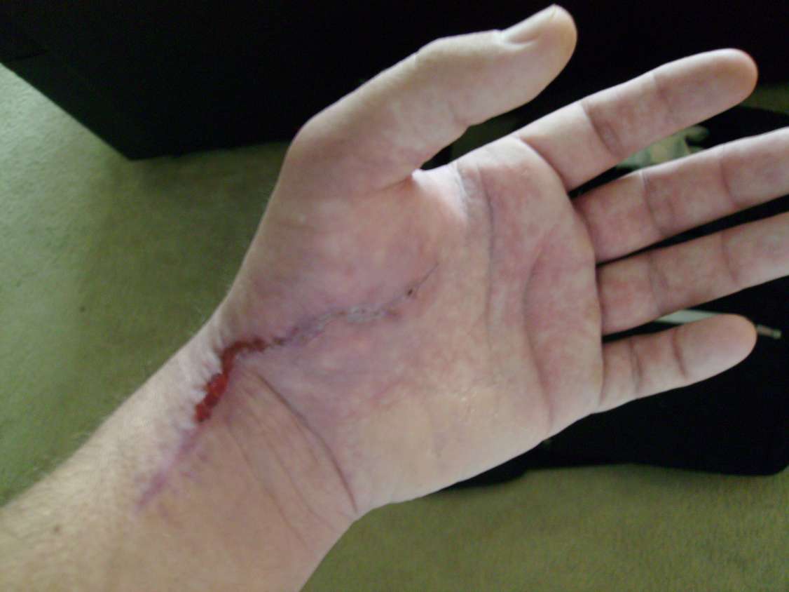 Injury Photo Page