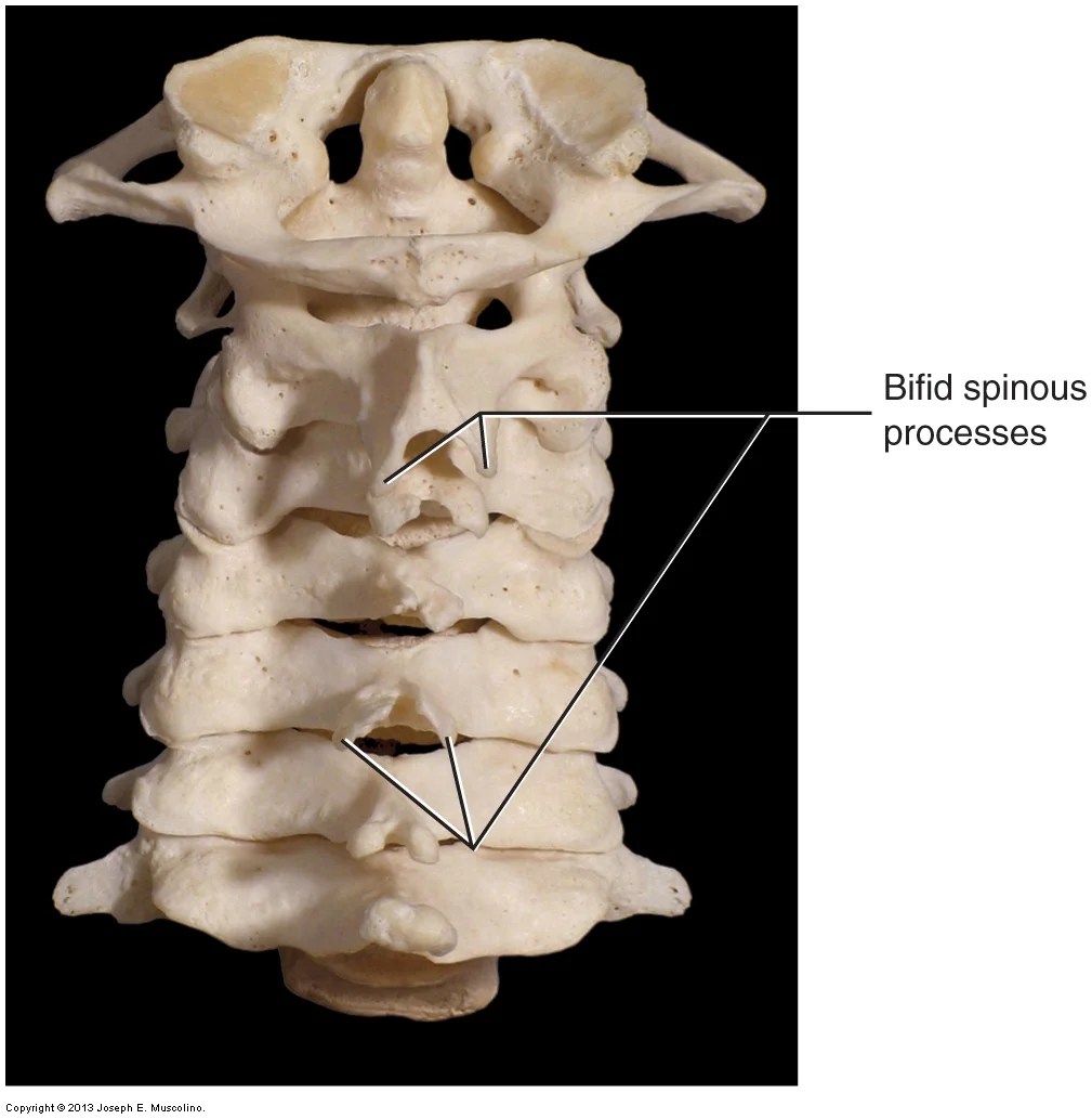 Introduction to (overview of) the cervical spine of the neck