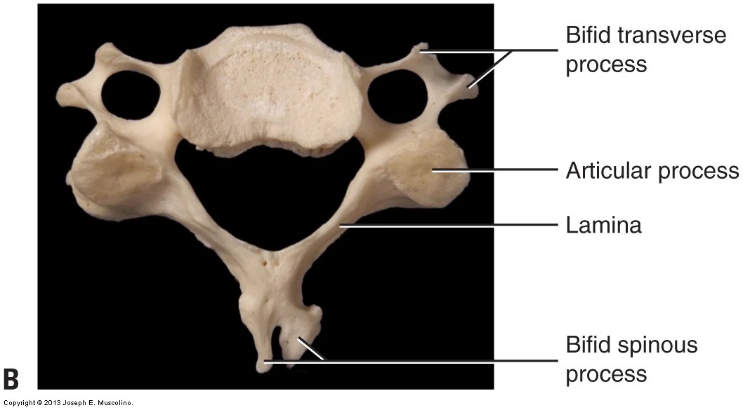 Introduction to (overview of) the cervical spine of the neck