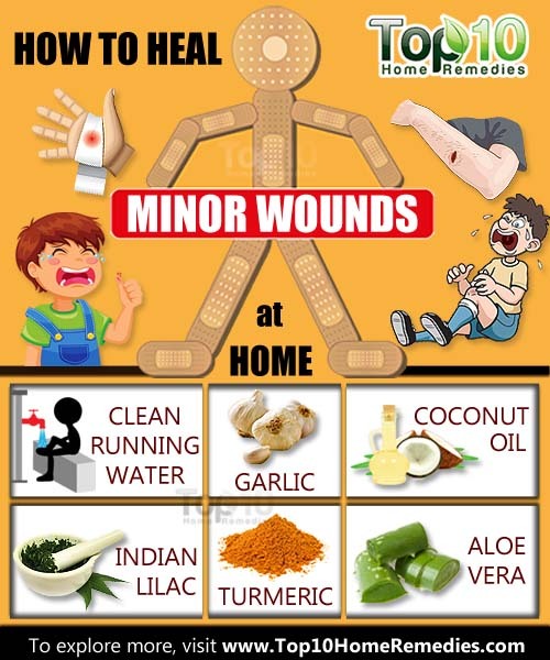 How to Heal Minor Wounds at Home Top 10 Home Remedies