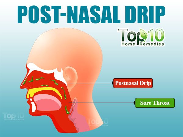 Home Remedies for PostNasal Drip Top 10 Home Remedies