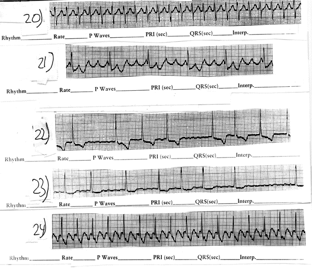EKG Oct 5 Oct 9