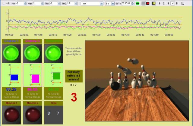 Neurofeedback