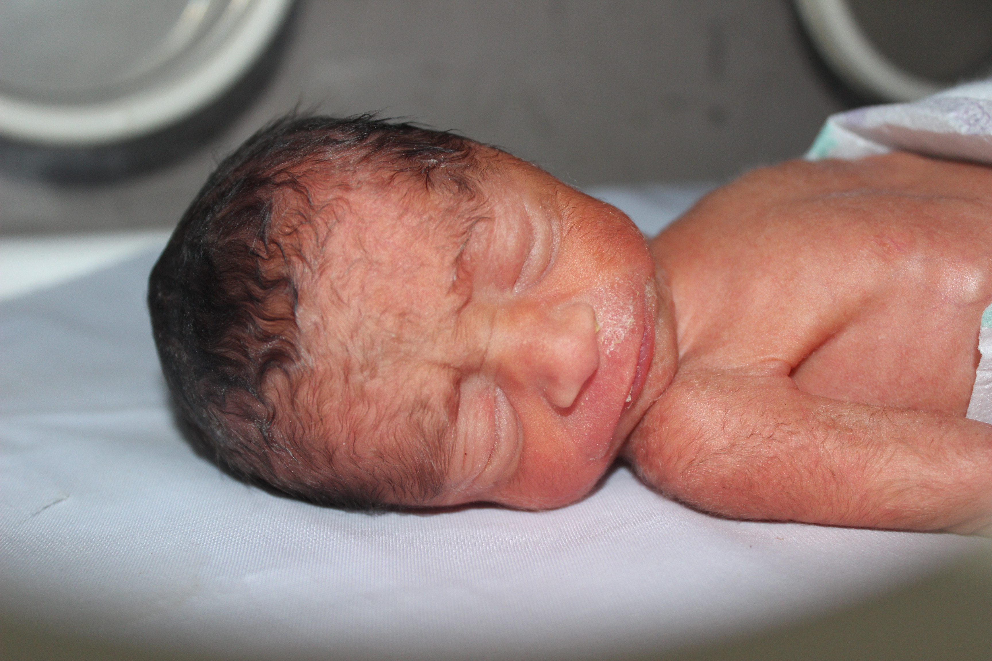 India has highest number of stillbirths in the world Report Indilens ! Live Daily News on India