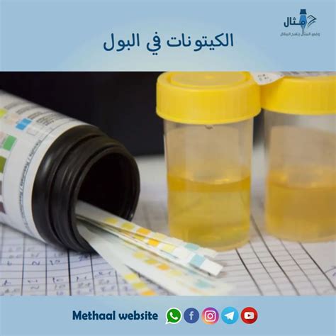  أسباب ارتفاع الكيتونات في البول عند الأطفال؟  - أخبار