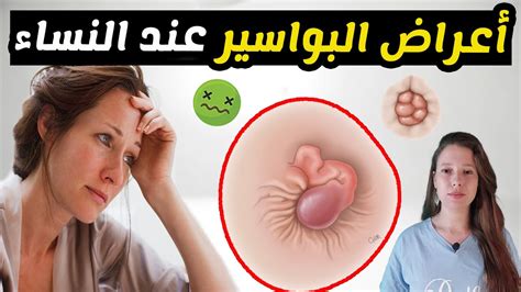  أعراض البواسير عند النساء والرجال ما هي؟  - طبي