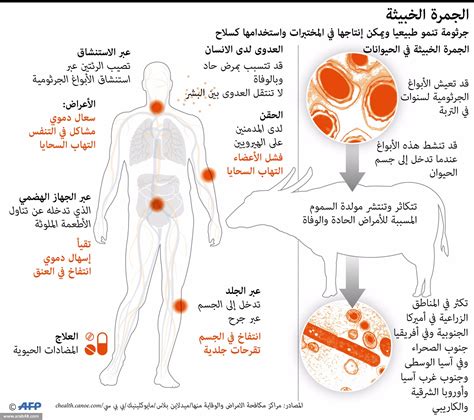  الجمرة الخبيثة الاسم العلمي فتال - منتديات عربية |  أسئلة وأجوبة 2024