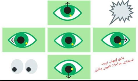  عندما تضرب الكرة برأسك، يجب أن تكون عينيك مغمضتين.  صحيح خطأ - أنت تعرف ذلك بشكل صحيح