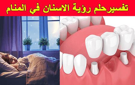  لرؤية أسنان بيضاء في المنام .. ماذا يعني ذلك؟  .. بشرة جيدة أم لا |  الرسول