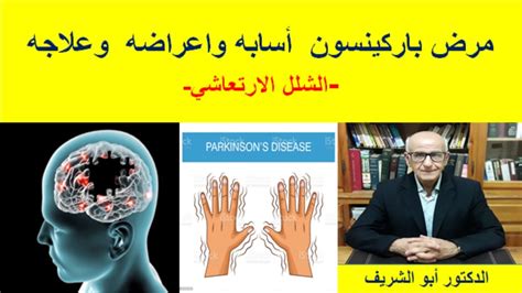 أسباب مرض باركنسون وأعراضه وعلاجه
