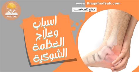 أقسام الشوكة - حلول معتمدة