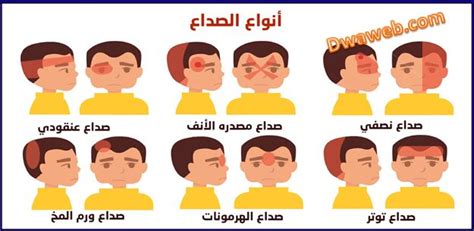أنواع الصداع وأسبابه وعلاجه