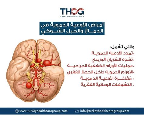 التصلب المتعدد - أمراض الدماغ والحبل الشوكي والأعصاب
