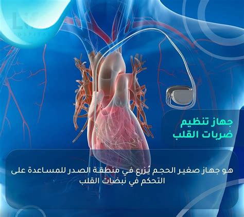الجواب على السؤال حول الجهاز الذي يمثل الصورة هو جهاز