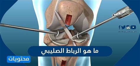 الرباط الصليبي الخلفي - ويكيبيديا
