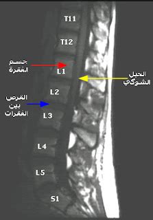 انفصال الفقرة 6 أحرف