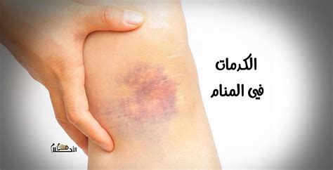 تأويلات ابن سيرين لتفسير حلم الكلاب السوداء - موقع مصري