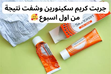 تجارب كريم سكينورين للتبييض وشافت نتيجه - موسوعة الازاهير