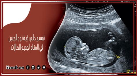 تفسير حلم الجنين المتحرك لامرأة متزوجة - مجلة سيدتي تفسير حلم الجنين المتحرك لامرأة متزوجة - مجلة سيدتي
