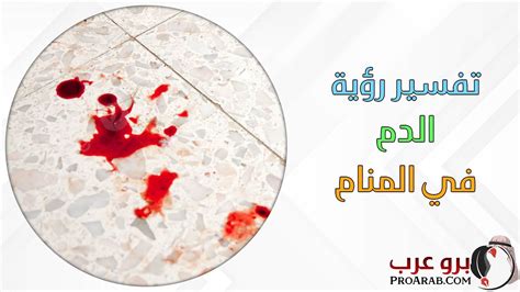 تفسير حلم الدم يأتي من الصنبور تفسير الدم في المنام - آخر شيء