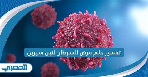 تفسير حلم السرطان جيداً وشرّاً لابن سيرين- الوكالة الوطنية للإعلام