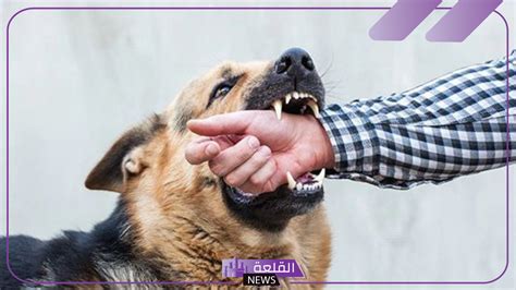 تفسير حلم رؤية عضة الكلب في المنام - التكية تفسير حلم رؤية عضة الكلب في المنام - التكية