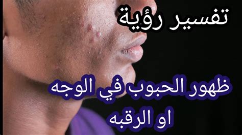 تفسير رؤية ظهور الحبوب في الجسم في المنام - موقع المحتوى
