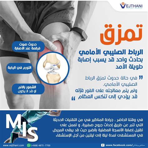 تمزق وتمزق الرباط الصليبي الأمامي - عيادة الركبة والفخذ