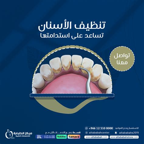 تنظيف الأسنان المنتظم يمنع الأمراض الخطيرة