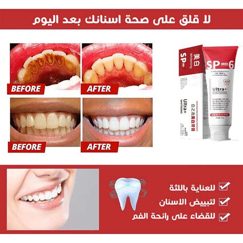 حبات الأسنان حبات الأسنان