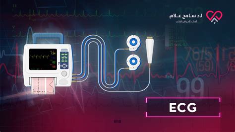 طريقة اختصار ECG - يوتيوب