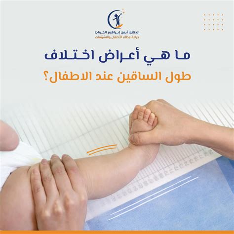 عظام الأطفال - أفضل إجابة