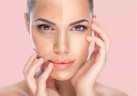 ما هو سعر توحيد لون الجسم بالليزر - اسألنا
