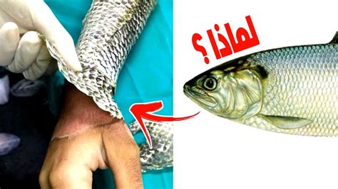 ما يغطي جسد سمكة - ذاكرتي