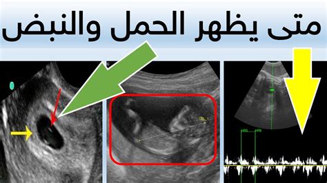 متى يظهر الحمل وفقًا للإبرة المتفجرة وموقع دوفاستون - كاسل