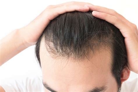 معالجة تساقط الشعر 31 طريقة من شأنها أن تتوقف عن التساقط على الفور - ثقف نفسك معالجة تساقط الشعر 31 طريقة من شأنها أن تتوقف عن التساقط على الفور - ثقف نفسك