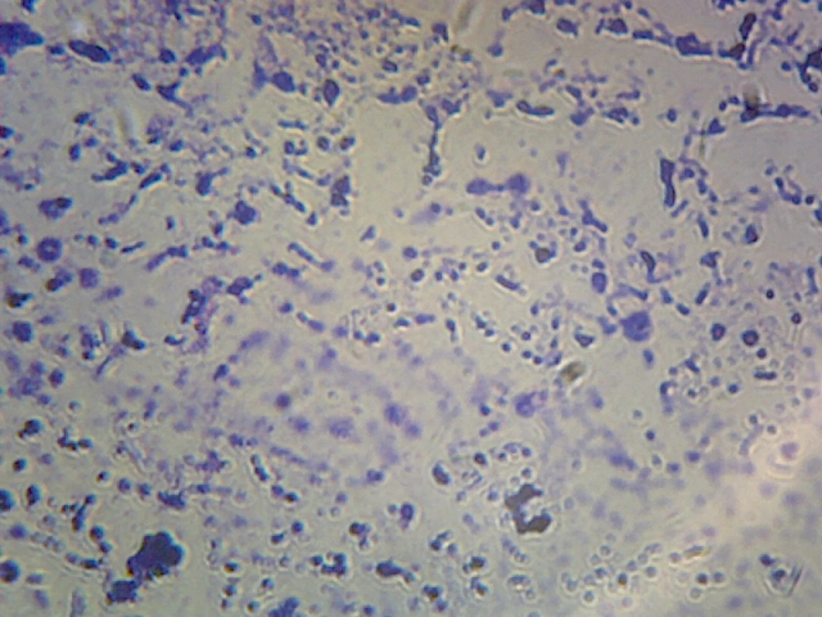 Clostridium Tetani, SporeForming Anaerobic Rods; Smear; GramPositive