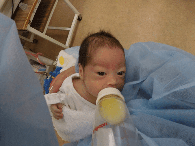 Premature Babies Are They Destined To Have Problems or Can We Make a Difference with