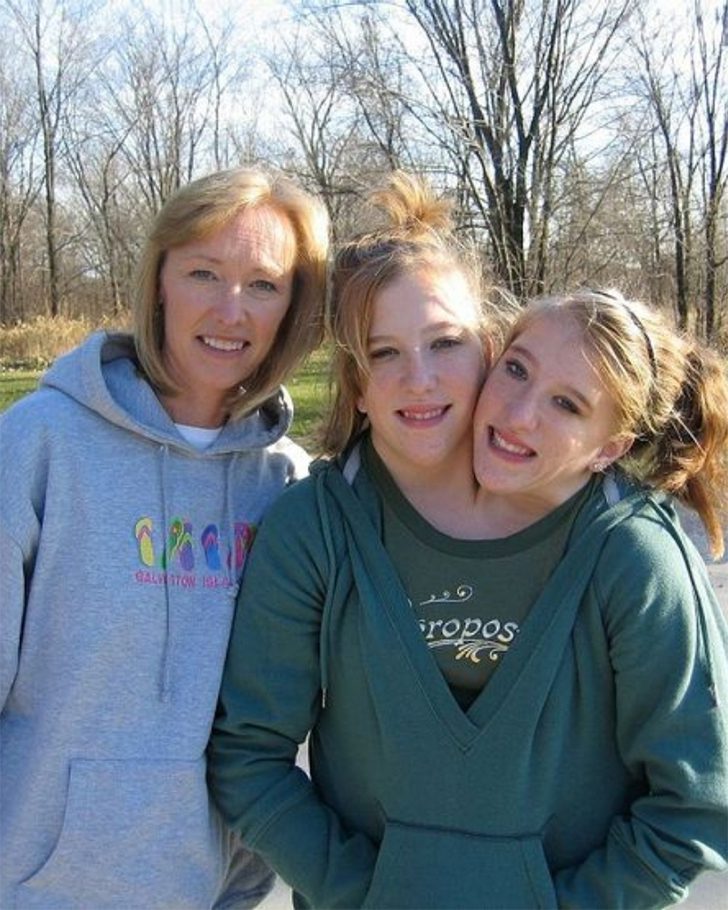 ¿Dónde están hoy las gemelas siamesas Brittany y Abby Hensel? Page 6