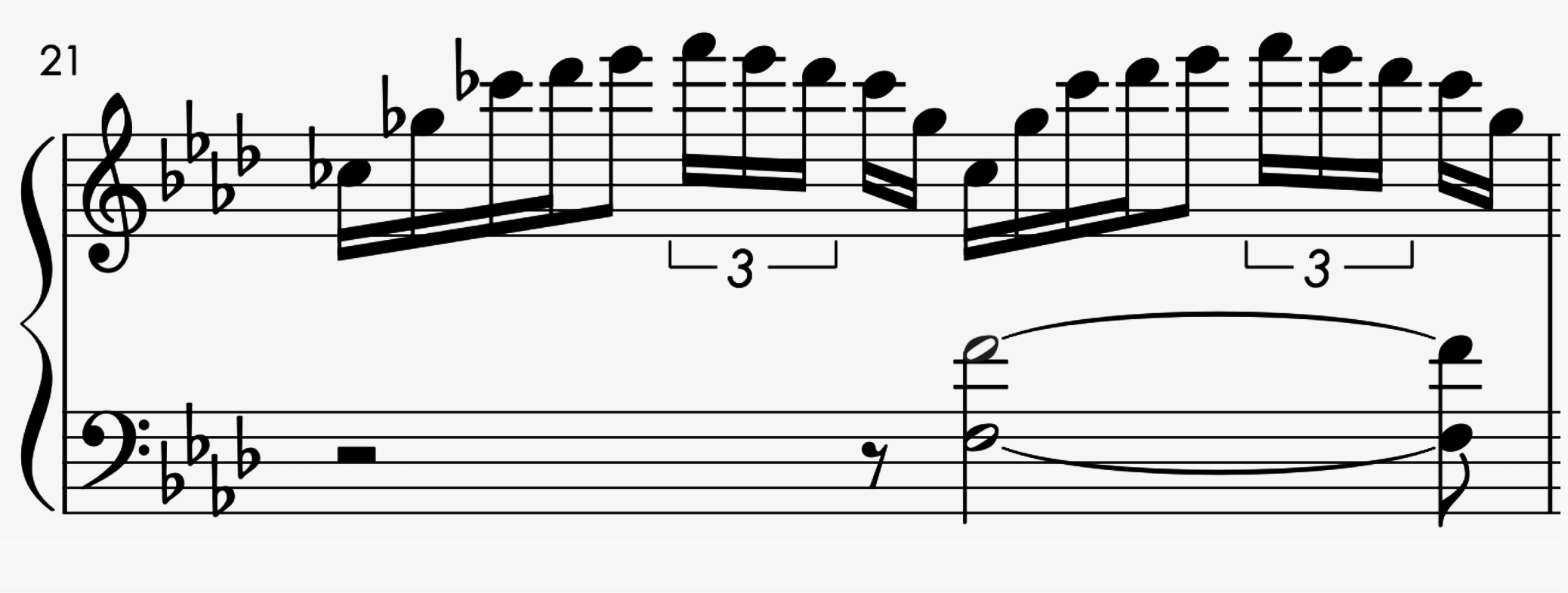 Star dots a new music notation for quintuple durations