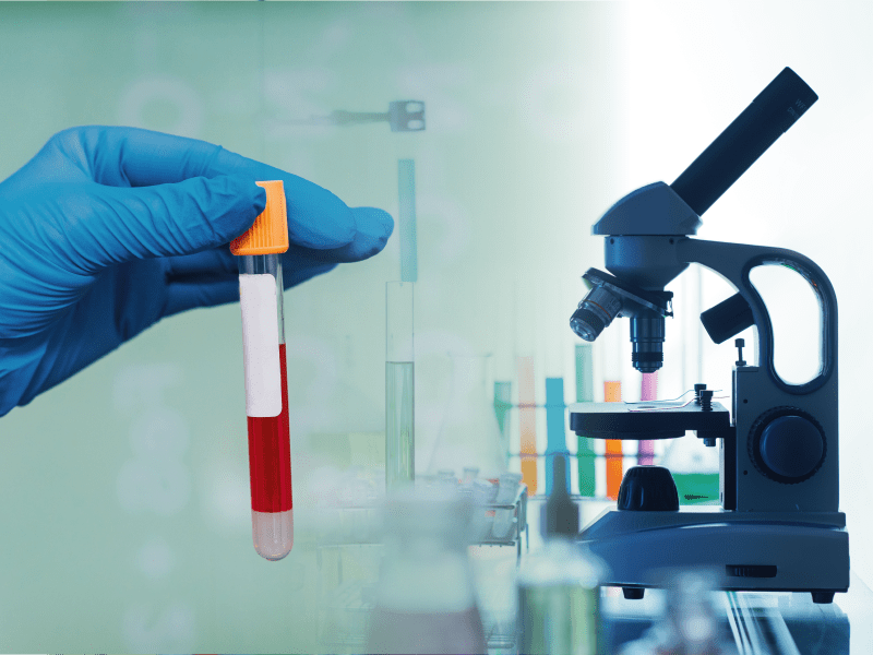 Perfil Férrico Nuevos Marcadores Bioquímicos de Utilidad en la