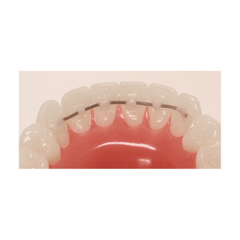 Retainers Wire IBDAA