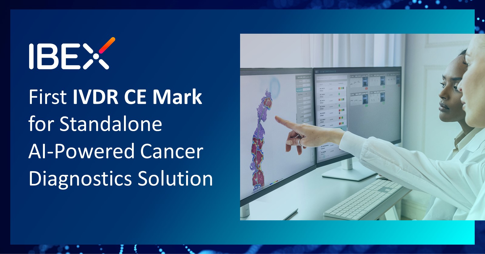 Ibex’s Galen™ Prostate first standalone AIpowered cancer