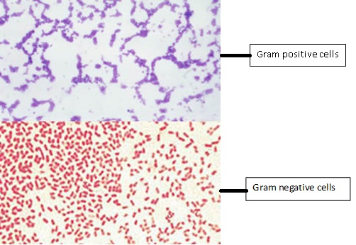Gram Staining Principle Procedure and Results