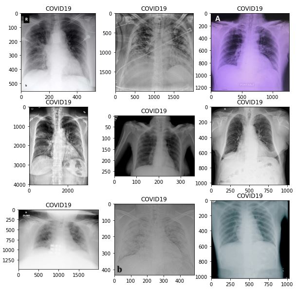 Chest Xray (Covid19 & Pneumonia) kaggleCOVID19Classification