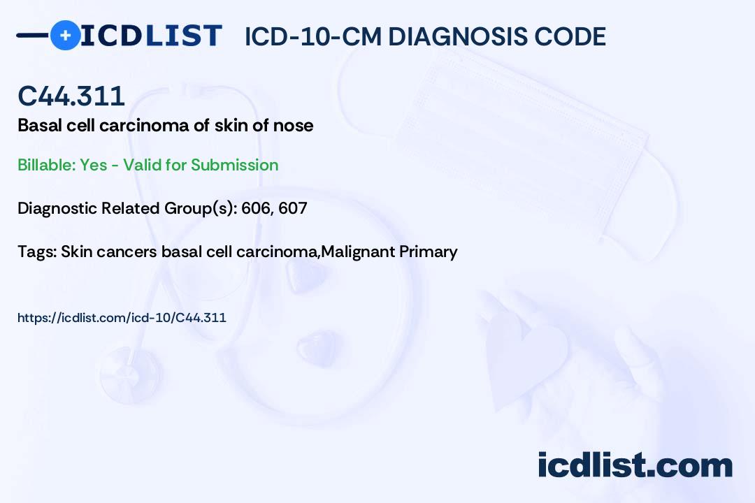 ICD10CM Diagnosis Code C44.311 Basal cell carcinoma of skin of nose