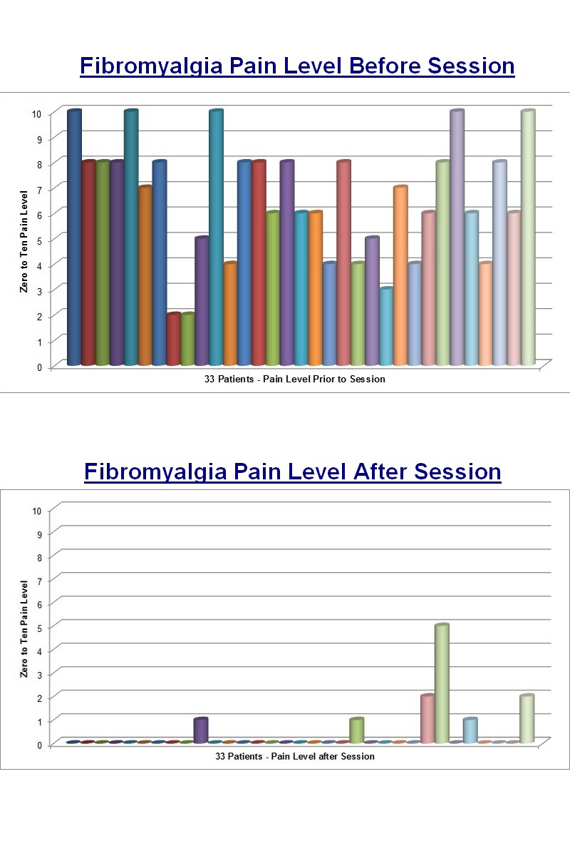 zFibromyalgia Study Ice Method
