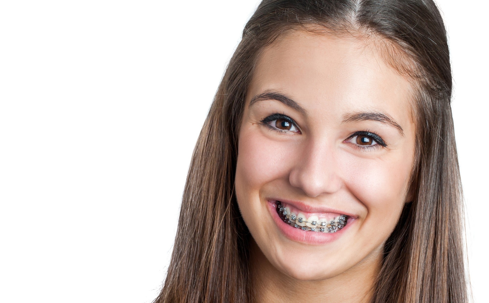 Taking Care of Your Braces Iowa City Orthodontics