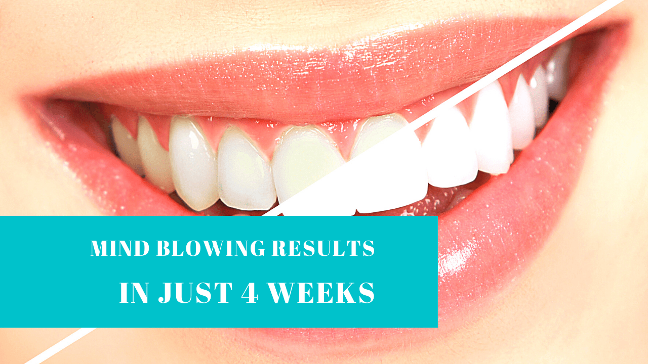 Snow Teeth Whitening Kit Reviews Does AllinOne Snow